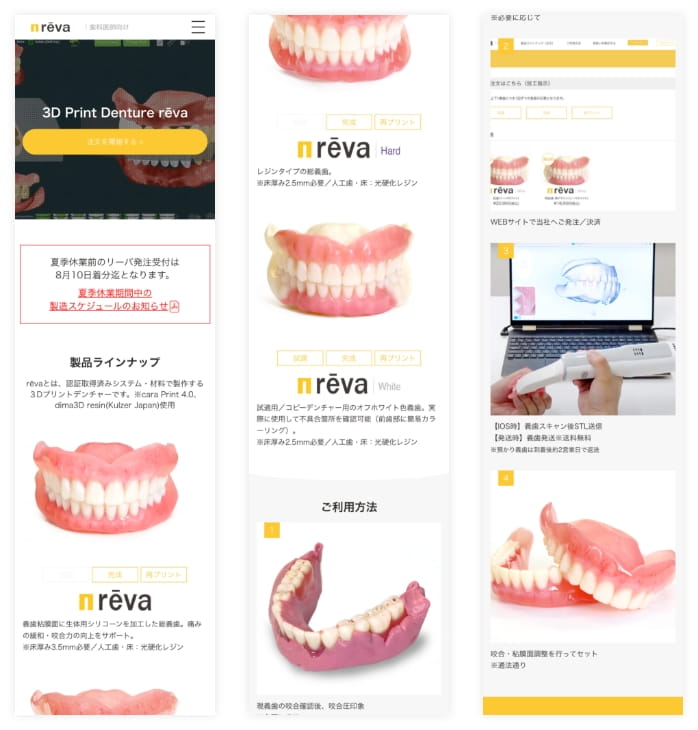 義歯の注文サイト